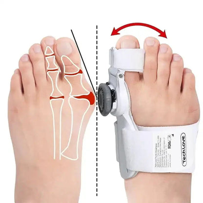 Universal Toe/Bunion Corrector