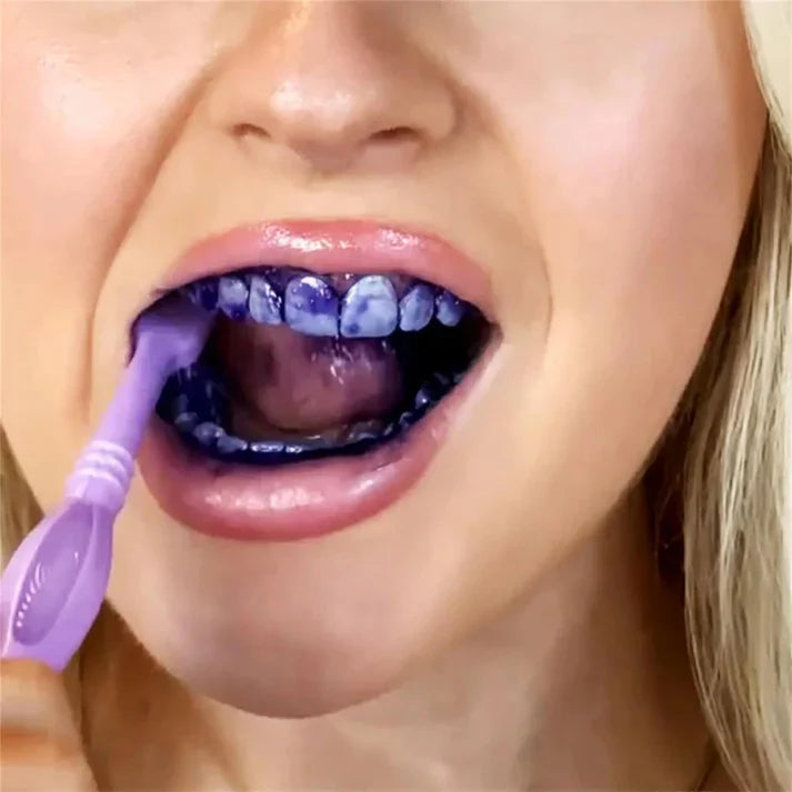 Smilekit Purple Whitening Toothpaste – Transform Your Smile